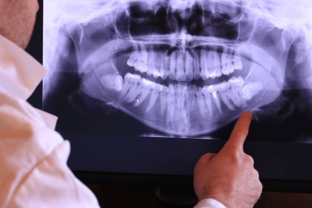 Best Emergency Treatment for Dental Infections or Abscesses in Elephant Butte, NM